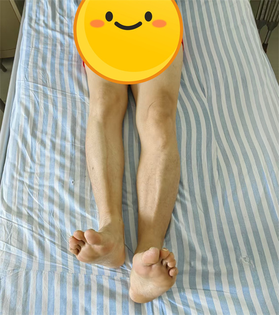 一場(chǎng)“天花板”級(jí)的手術(shù)，還他無(wú)痛生活