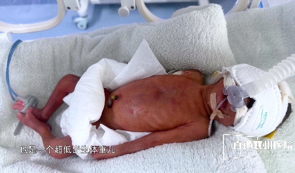 【直通襄州醫(yī)院?】過五關(guān)斬六將 為早到的天使保駕護(hù)航