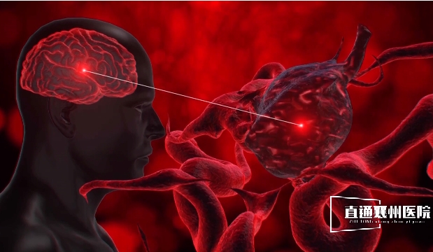 【直通襄州醫(yī)院?】夾閉腦動(dòng)脈瘤 顯微鏡下的毫米級操作