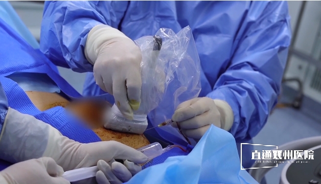 【直通襄州醫(yī)院⑨】超聲介入“針”功夫